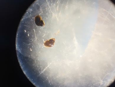 Two tan snails enlarged under a microscope
