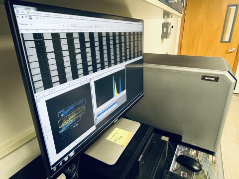 Monitor screen shows results of chromosome analysis of grass carp.