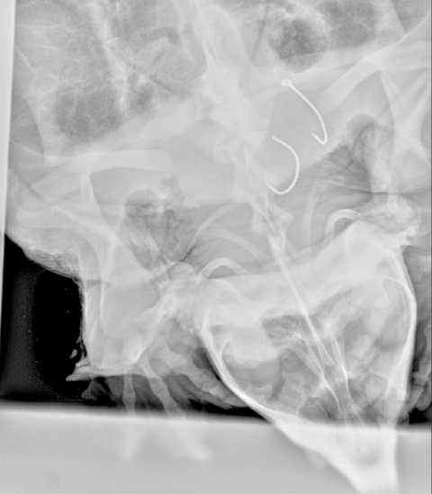 An x-ray image shows a 75-pound male alligator snapping turtle from the Big Black River, Miss. with two hooks in his throat August 7, 2024. (Photo by Luke Pearson, USFWS)